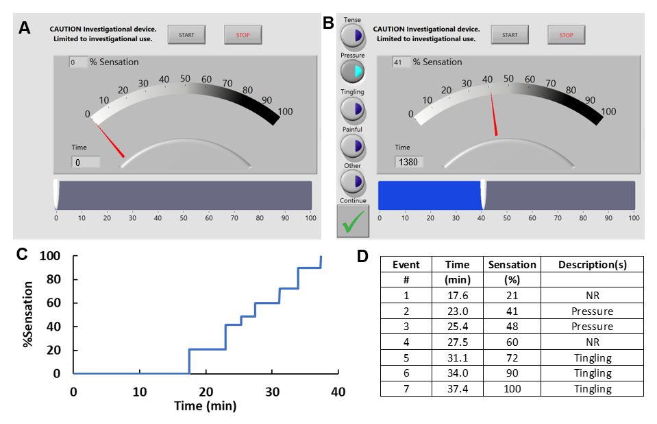 Comparison of Sensation Event Descriptors in Participants with Overactive and Normal Bladders during Non-Invasive Hydration Studies